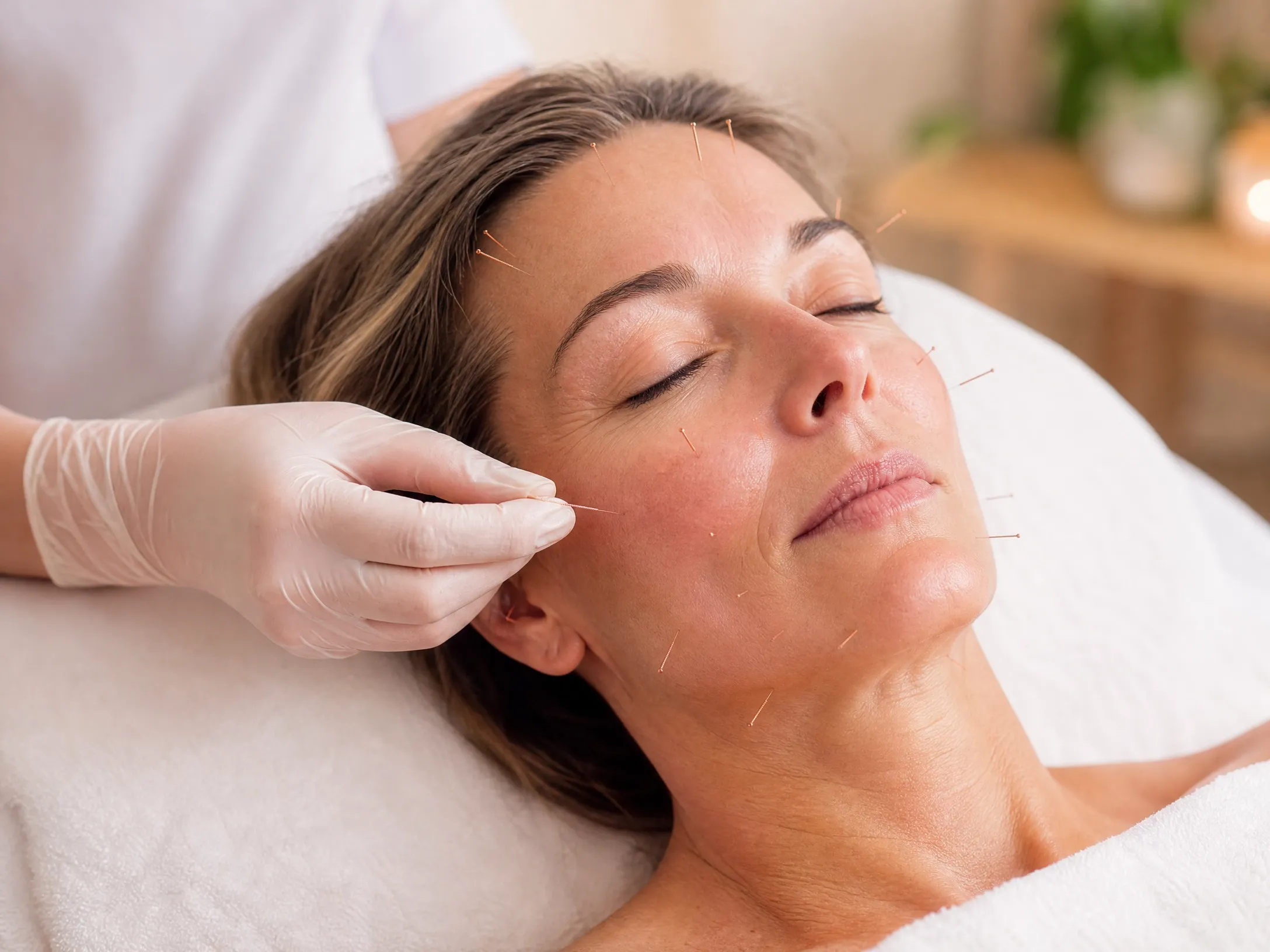 Facial Rejuvenation Therapy in Great Neck, NY - Natural Acupuncture Facelift